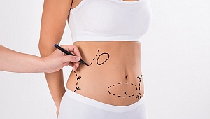 Liposuction nedir ve fiyatları nedir?