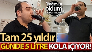 25 yıldır günde 5 litre kola içiyor