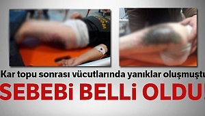 Afyonkarahisar'da öğrencilerin vücutlarındaki yanıkların sebebi belli oldu