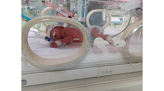 Çift rahimli kadın'ın çifte bebek mutluluğu