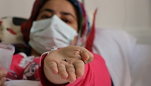 Kız bebekken yuttuğu toplu iğneden 17 yıl sonra kurtuldu