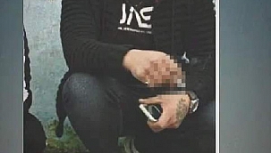 Aydın'da boşandığı eşi tarafından bıçaklanan genç kadın ağır yaralandı