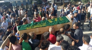 10 günlük yaşam mücadelesini kaybetti