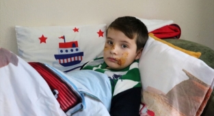 Sokak Köpeği Saldırısına Uğradı