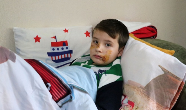 Sokak Köpeği Saldırısına Uğradı