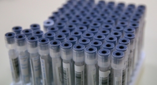 Bazı alanlarda PCR testi zorunluluğu kaldırıldı