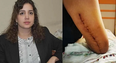 Sevgilisinin kolunu kıran sanığın cezası arttırıldı