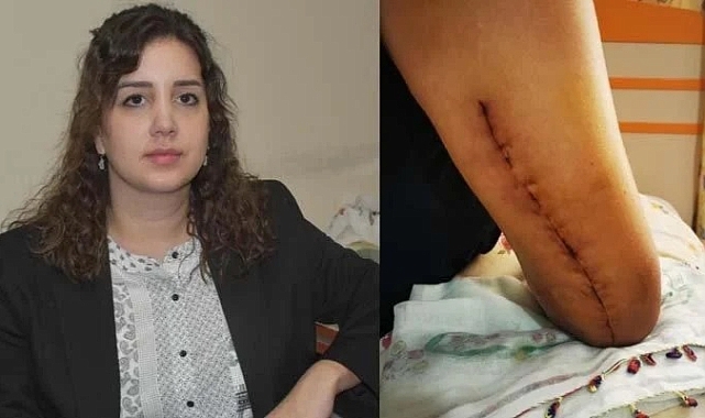 Sevgilisinin kolunu kıran sanığın cezası arttırıldı