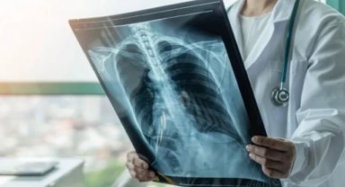 2023 yılında en çok ölüm, hangi hastalıktan kaynaklandı?