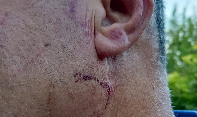 AK Parti Urla&#039;da Darp İddiası: