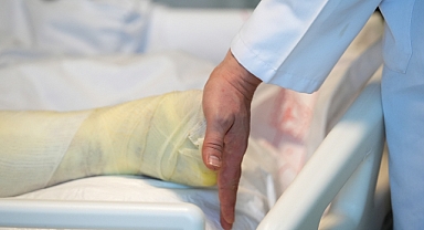 Yanık Vakaları Sosyal Medya Etkisi