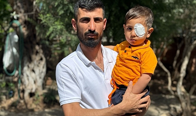 Aydın’da 3 Yaşındaki Çocuğa Köpek Saldırısı