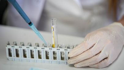 Beyin Sıvısındaki İz, Depresyona Erken Tanı Umudu