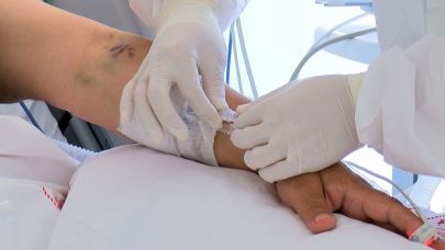 Yarım Milyon Kişi Hepatit C Taşıdığından Habersiz