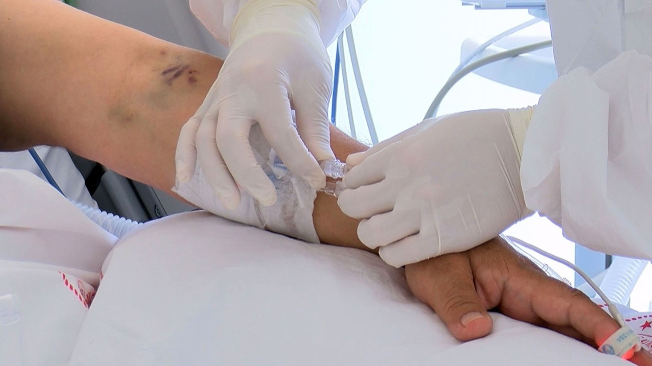 Yarım Milyon Kişi Hepatit C Taşıdığından Habersiz