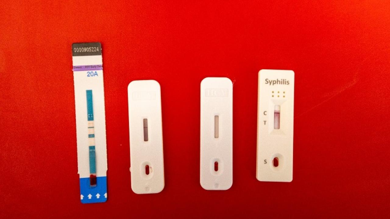 İzmir’de kimliksiz ve ücretsiz test dönemi başladı