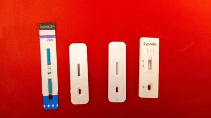 İzmir’de kimliksiz ve ücretsiz test dönemi başladı