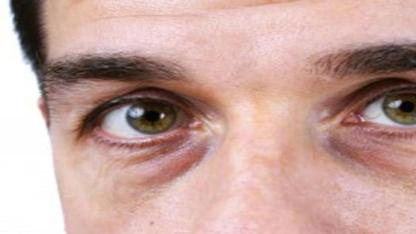 Göz Pınarları Kurudu.