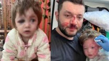 Bereket’ten Yalova’daki Bebek Yaralanmasına Tepki